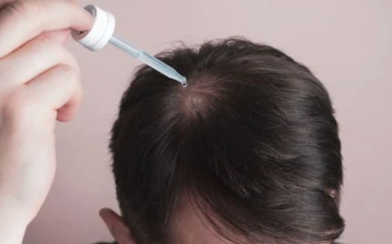 Man applying a scalp serum with a dropper to promote hair regrowth.