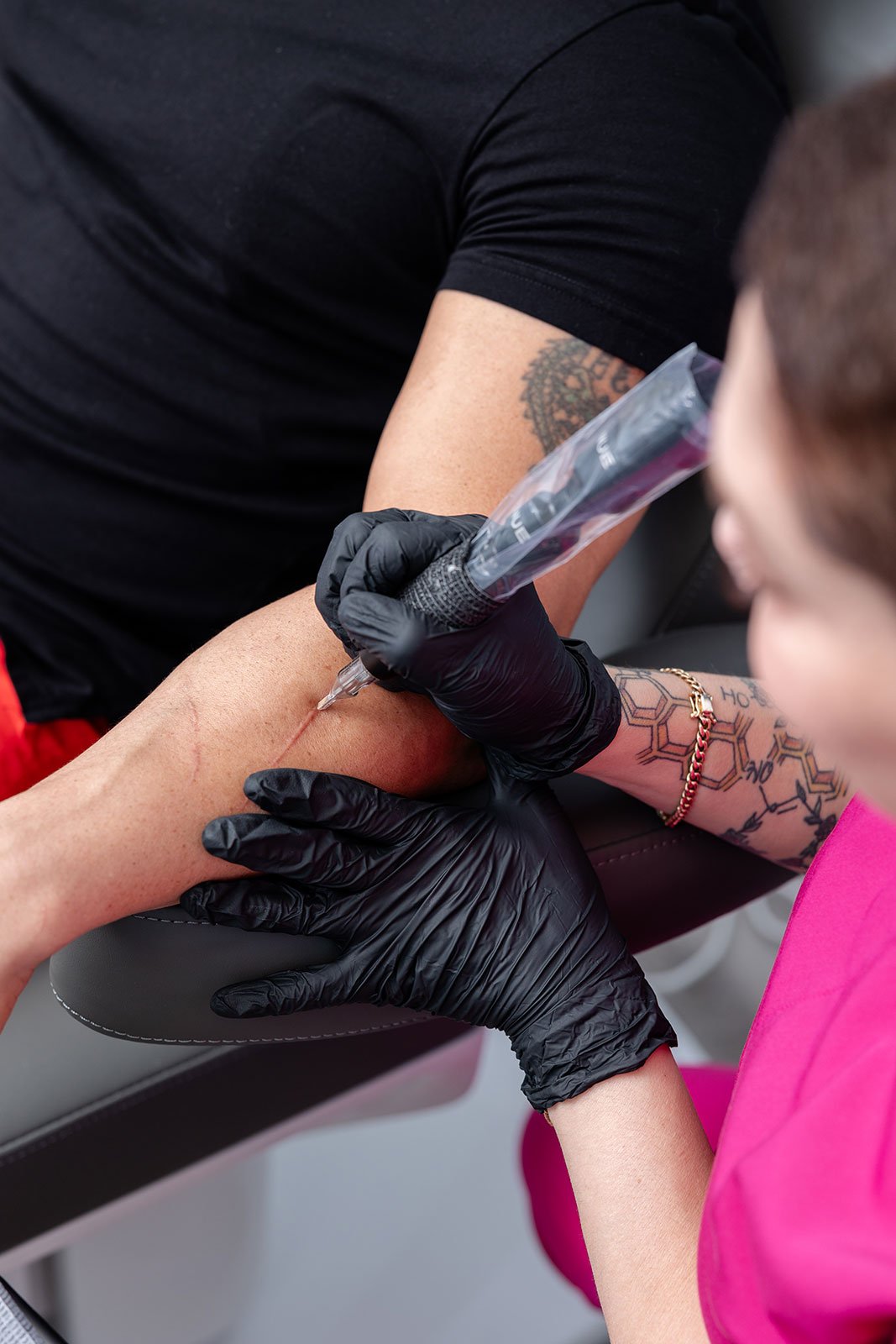 Paramedical tattoo artist performing a scar camouflage procedure on a client’s arm using a precision tattoo machine.