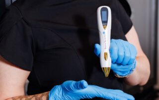 Médico estético de la clínica OgzySkin sujetando un dispositivo Plasma Pen para tratamientos no quirúrgicos de estiramiento cutáneo y estimulación del colágeno.