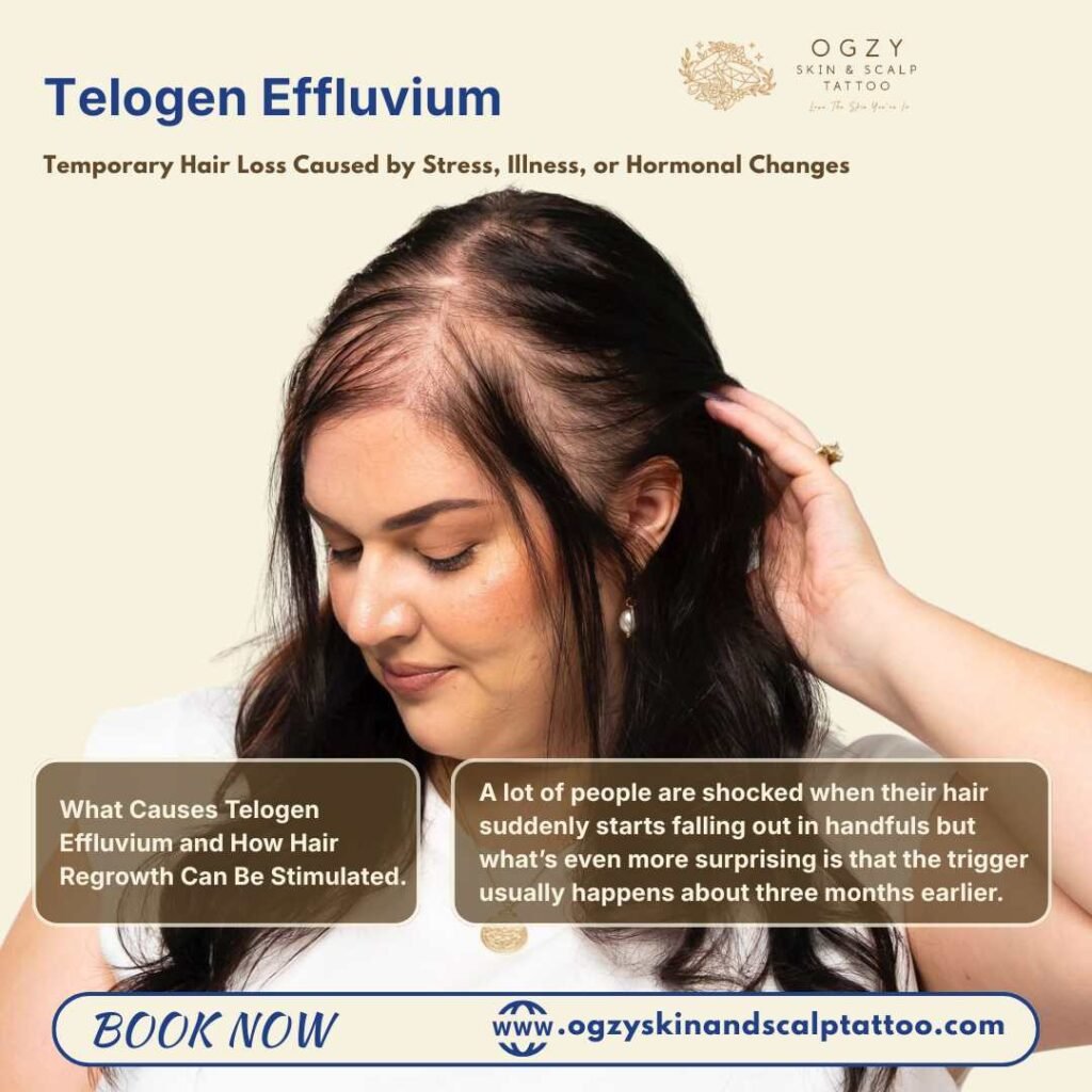 Temporary Hair Loss Caused by Stress, Illness, or Hormonal Changes
